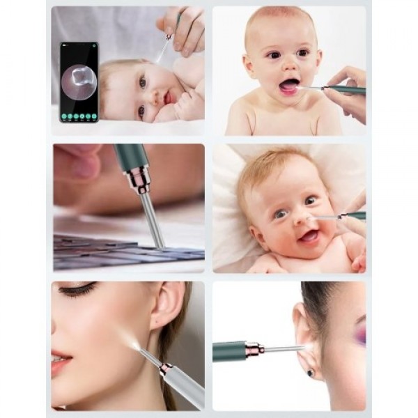 Wireless Endoscope WiFi Medical In Ear Cleaning Spoon